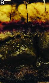 What's your diagnosis? - October 2018